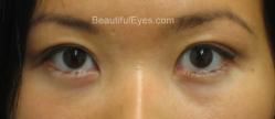 Patient # 36953 After Photo # 2